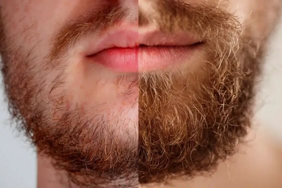 Beard Growth Oil